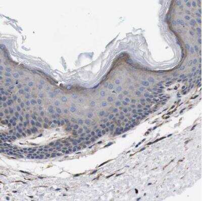 Immunohistochemistry-Paraffin: Wnt-10a Antibody [NBP1-86081]