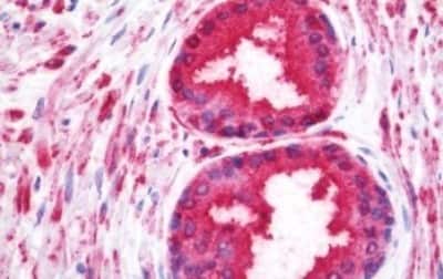 Immunohistochemistry-Paraffin: Wnt-10a Antibody [NBP3-14379]