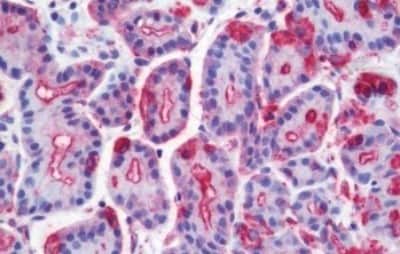 Immunohistochemistry-Paraffin: Wnt-10a Antibody [NBP3-14379]
