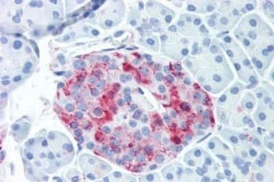 Immunohistochemistry-Paraffin: Wnt-10a Antibody [NBP3-14379]