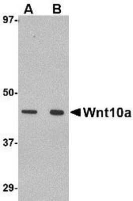 Western Blot: Wnt-10a AntibodyBSA Free [NBP1-76916]