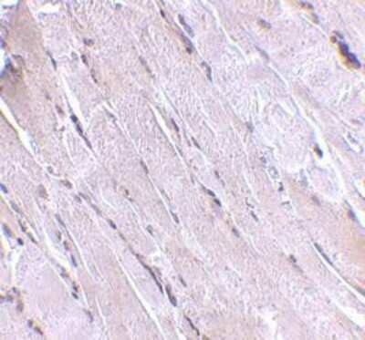 Immunohistochemistry-Paraffin: Wnt-10b Antibody - BSA Free [NBP1-77325]