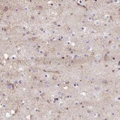 Immunohistochemistry-Paraffin: Wnt-10b Antibody [NBP2-49165]