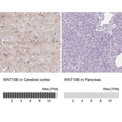 Immunohistochemistry-Paraffin: Wnt-10b Antibody [NBP2-49165]