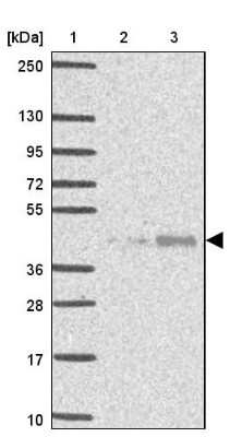 Western Blot: Wnt-10b Antibody [NBP2-49165]