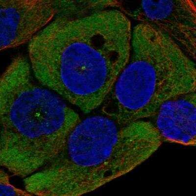 Immunocytochemistry/ Immunofluorescence: Wnt-11 Antibody [NBP2-57600]