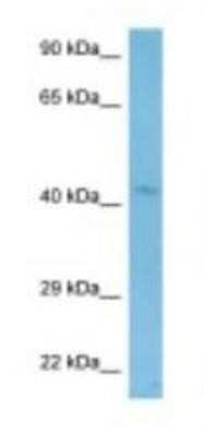 Western Blot: Wnt-2 Antibody [NBP1-98349]