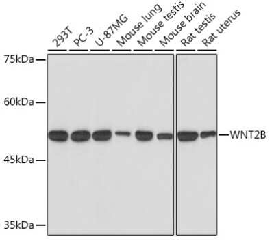 Western Blot: Wnt-2b Antibody (9M6O7) [NBP3-15772]