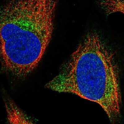 Immunocytochemistry/ Immunofluorescence: Wnt-2b Antibody [NBP2-56921]