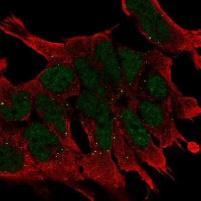 Immunocytochemistry/ Immunofluorescence: Wnt-2b Antibody [NBP2-68677]