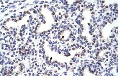 Immunohistochemistry-Paraffin: Wnt-2b Antibody [NBP1-53120]
