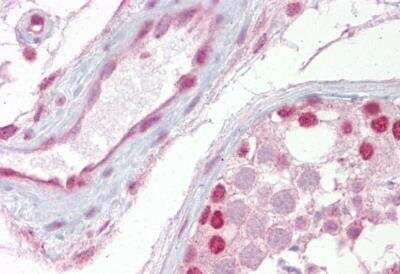Immunohistochemistry-Paraffin: Wnt-2b Antibody [NBP1-53120]