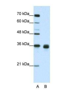 Western Blot: Wnt-2b Antibody [NBP1-53120]