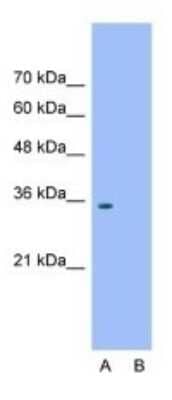 Western Blot: Wnt-2b Antibody [NBP1-53120]