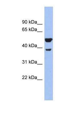 Western Blot: Wnt-3a Antibody [NBP1-79724]