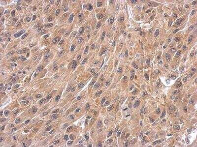Immunohistochemistry-Paraffin: Wnt-4 Antibody [NBP2-20909]