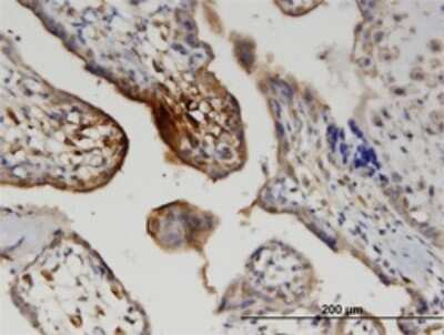 Immunohistochemistry-Paraffin: Wnt-5a Antibody (3A4) [H00007474-M04]