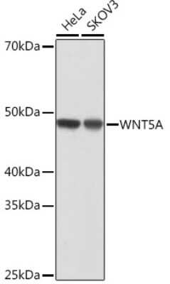 Western Blot: Wnt-5a Antibody (3P2E8) [NBP3-15684]