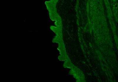 Immunohistochemistry-Frozen: Wnt-5a Antibody - BSA Free [NBP2-24752]