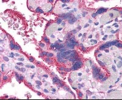 Immunohistochemistry-Paraffin: Wnt-5a Antibody [NBP1-60032]