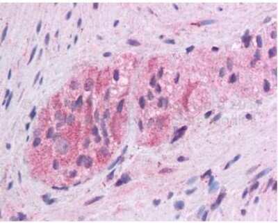 Immunohistochemistry-Paraffin: Wnt-5a Antibody [NBP1-60032]