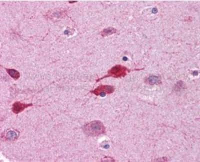 Immunohistochemistry-Paraffin: Wnt-5a Antibody [NBP1-60032]