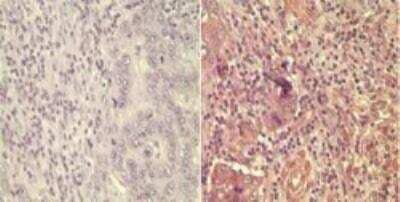 Immunohistochemistry-Paraffin: Wnt-5a Antibody - BSA Free [NBP2-24752]