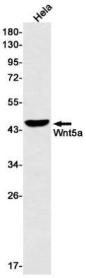 Western Blot: Wnt-5a Antibody (S08-4A3) [NBP3-20061]