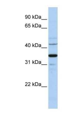 Western Blot: Wnt-5a Antibody [NBP1-60032]