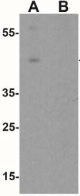 Western Blot: Wnt-5b AntibodyBSA Free [NBP2-41306]