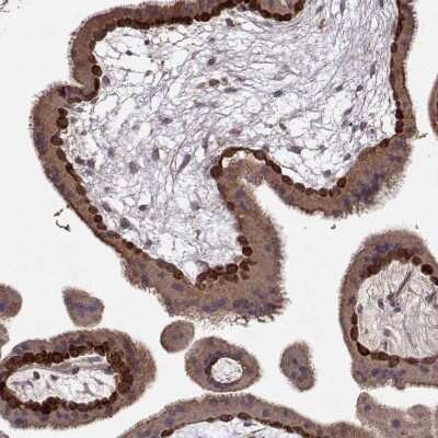 Immunohistochemistry-Paraffin: Wnt-6 Antibody [NBP2-68908]