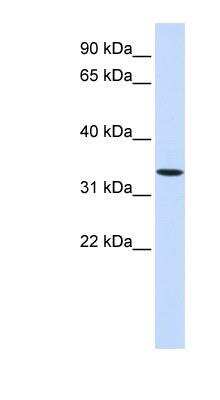 Western Blot: Wnt-6 Antibody [NBP1-62305]