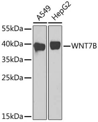 Western Blot: Wnt-7b AntibodyBSA Free [NBP2-93321]