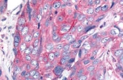 Immunohistochemistry: Wnt-8a Antibody [NBP3-14523]