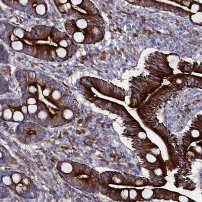 Immunohistochemistry-Paraffin: Wnt-8a Antibody [NBP1-86853]