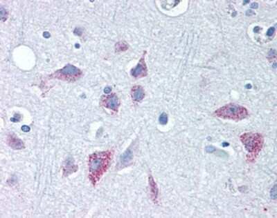 Immunohistochemistry-Paraffin: Wnt-8b Antibody - BSA Free [NBP1-39604]