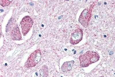 Immunohistochemistry-Paraffin: Wnt-8b Antibody - BSA Free [NBP1-39604]