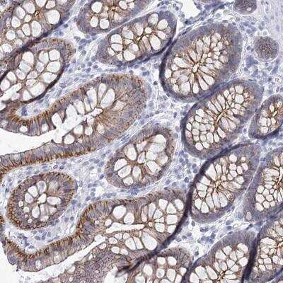 Immunohistochemistry-Paraffin: Wnt-8b Antibody [NBP1-86285]