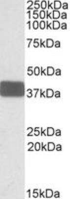 Western Blot: Wnt-9b Antibody [NBP1-51961]