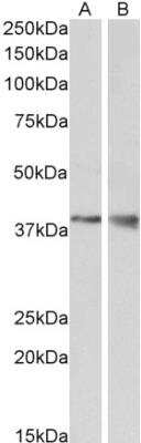 Western Blot: Wnt-9b Antibody [NBP1-51961]