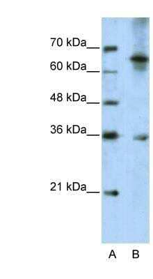 Western Blot: Wnt-9b Antibody [NBP1-57937]