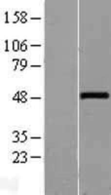 Western Blot: Wnt-10a Overexpression Lysate [NBL1-17861]