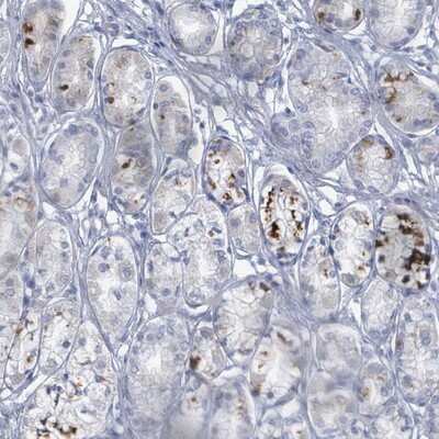 Immunohistochemistry-Paraffin: Wnt-11 Antibody [NBP2-13523]