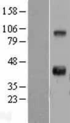 Western Blot: Wnt-11 Overexpression Lysate [NBL1-17863]