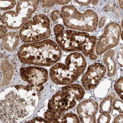 Immunohistochemistry-Paraffin: Wnt16 Antibody [NBP1-86403]