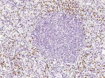 Immunohistochemistry-Paraffin: Wnt16 Antibody [NBP2-99324]