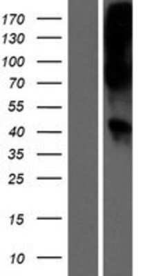 Western Blot: Wnt16 Overexpression Lysate [NBL1-17864]