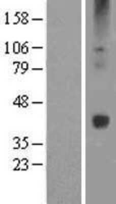 Western Blot: Wnt16 Overexpression Lysate [NBL1-17865]