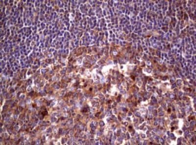 Immunohistochemistry: Wnt3 Antibody (OTI1G7) [NBP2-46367]