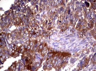 Immunohistochemistry: Wnt3 Antibody (OTI1G7) [NBP2-46367]